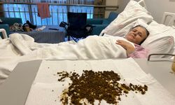 Manisalı kadının karnından 20 binden fazla taş çıktı