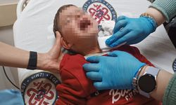 Parkta oynayan 2 yaşındaki çocuğa bıçaklı saldırı