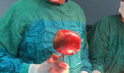 Manisa'da ağrı şikayetiyle giden hastanın mesanesinden 1 kiloluk taş çıkarıldı