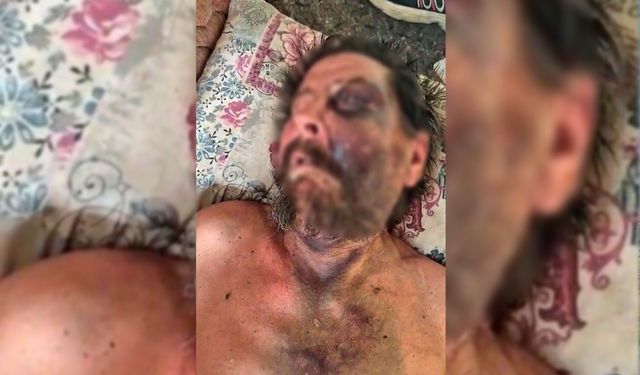Feci dayak sonrası ölüme terk edildi