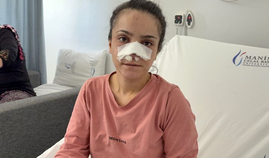 Manisa'da eşinin burnunu ısırarak koparan koca tutuklandı