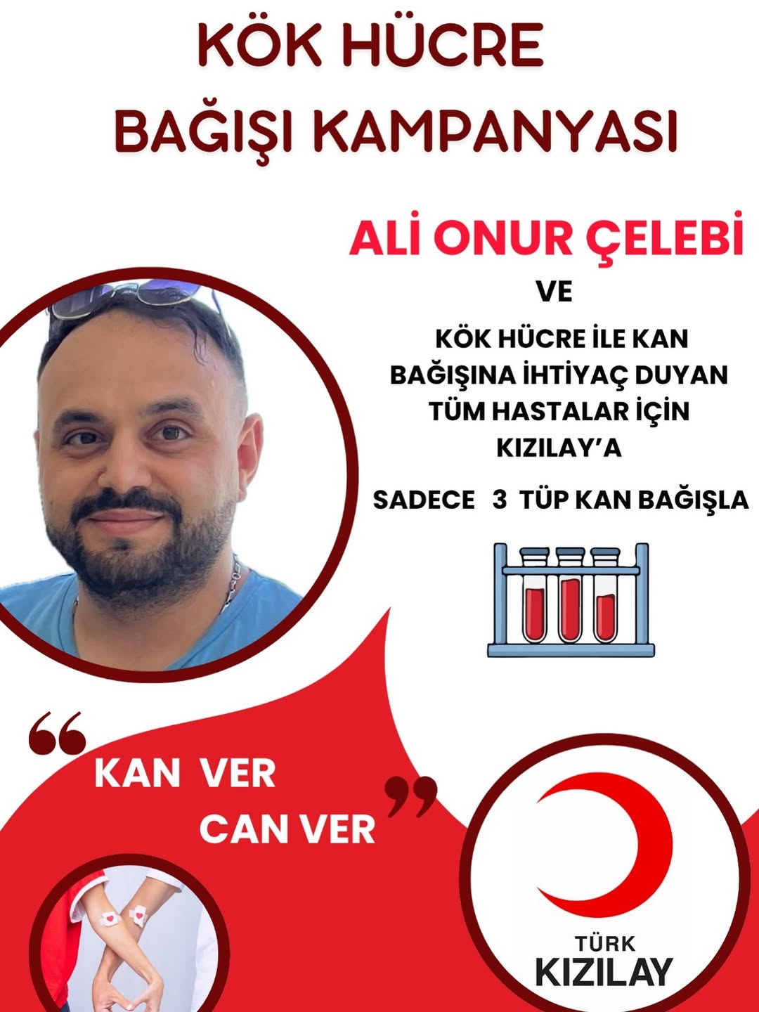 Hayat Arkadaşım, Eşim 5 Kasım Çarşamba Günü “Öksürük Sebebiyle Gittiğimiz Hastaneden” Akut Miyel